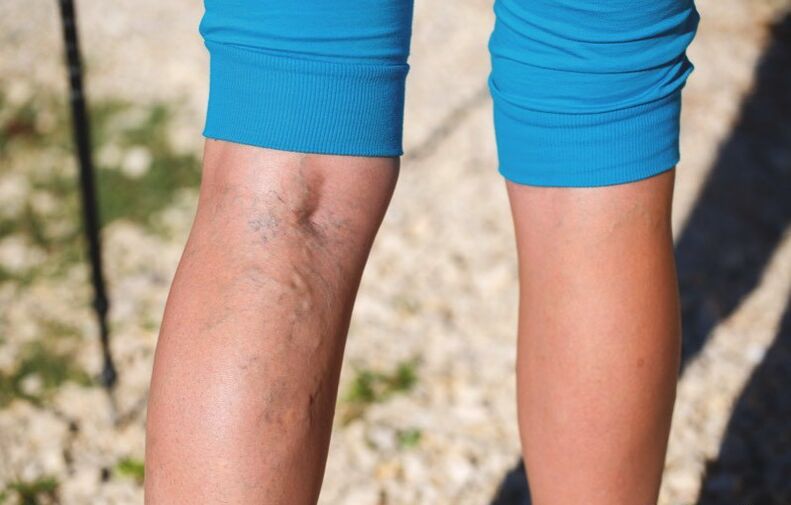 Alt ekstremitelere verilen hasar